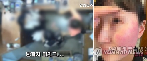 폭행 혐의로 경찰 조사를 받고 있는 주한 벨기에 대사 부인에게 뺨을 맞은 피해자인 옷가게 점원과 가족이 볼이 부은 사진과 폭행 당시 CCTV 영상을 20일 공개했다.