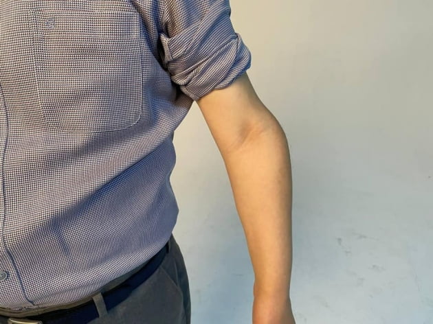 이재명 경기도지사가 올린 팔 사진 / 사진=페이스북 캡처