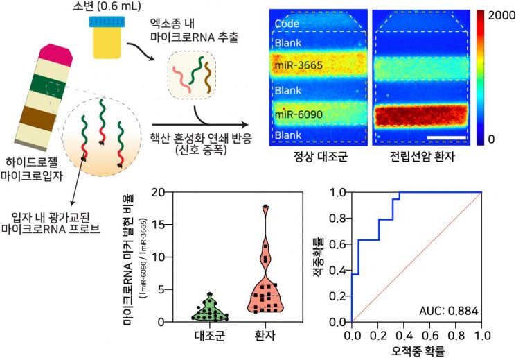 채혈없이 소변으로 전립선암 진단한다