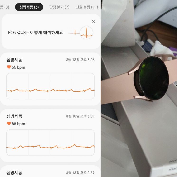 지난 19일 한 온라인 커뮤니티에 '갤럭시워치4로 와이프 백신 아스트라제네카(AZ) 부작용 잡아냈다'는 글을 올린 A씨가 사용 중인 갤럭시워치4 사진과 심전도 측정 결과가 나온 사진을 공유했다. [사진=에펨코리아 캡처]