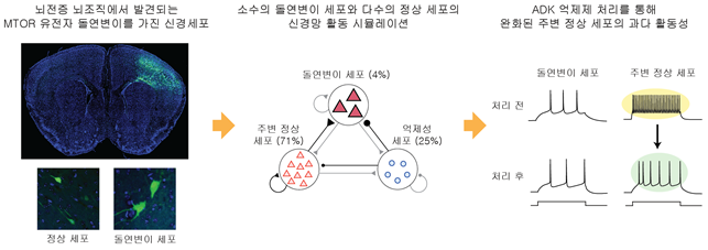 약물 안 듣는 뇌전증 발병 원인 규명…새 치료법 실마리