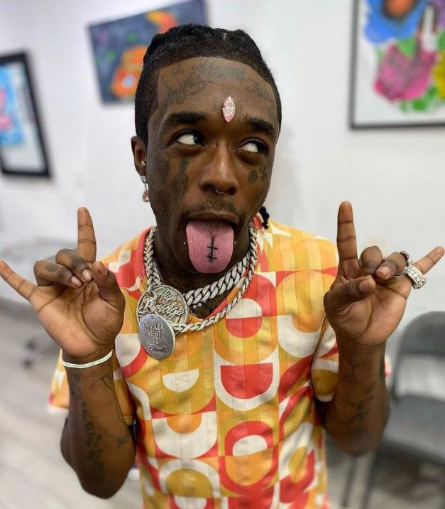 이마에 270억 다이아 박은 美 래퍼 "공연중 팬이 잡아 뜯어"