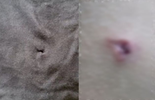 후배 등에 활 쏜 양궁 학폭 중학생, '영구 제명' 징계..."양궁계 퇴출"