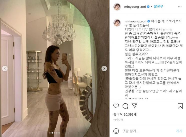 "건강 주사 맞고 온몸에 피멍"…부작용 호소한 유튜버