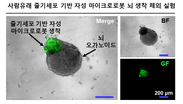 사람유래 줄기세포 기반 자성 마이크로로봇의 배아 쥐(Rat embryo) 마이크로 뇌 오가노이드 생착 체외 실험.