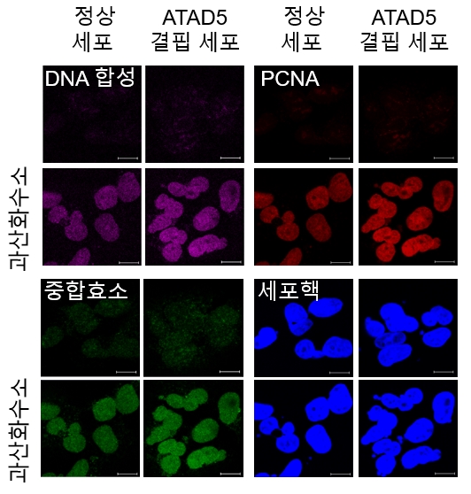 ＜활성산소 손상 DNA 복구 단백질 발견＞

[그림1] 활성산소에 의한 복구 DNA 합성은 ATAD5 단백질 결핍 시 늘어난다.  
   과산화수소를 처리해서 세포내 활성산소 농도를 높이면 PCNA와 DNA 중합효소의 DNA 결합 및 복구 DNA 합성이 일어난다. ATAD5 단백질 결핍 시 PCNA가 DNA에 축적되고, 복구 DNA 합성이 더욱 늘어난다.