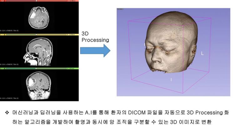 수술실에서 3D 홀로그램 활용 기술, 본격 상용화 착수