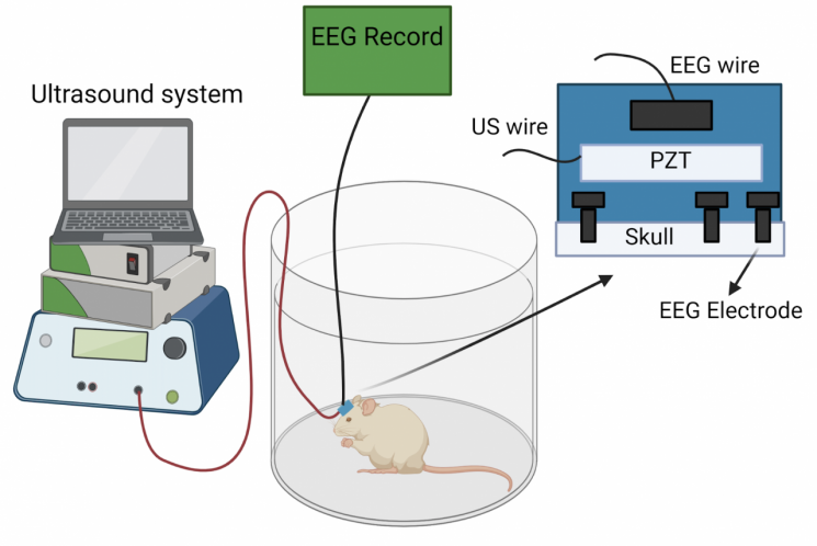 최근 지스트(광주과학기술원) 연구팀은 생쥐 모델에 하루 2시간씩 40Hz의 초음파 진동을 줬더니 치매 원인 물질 감소 및 증상 개선 효과를 거뒀다고 밝혔다. 그림 제공=지스트.