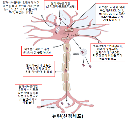 국내 연구진, 파킨슨병 효율적 예방 및 치료 전략 체계화