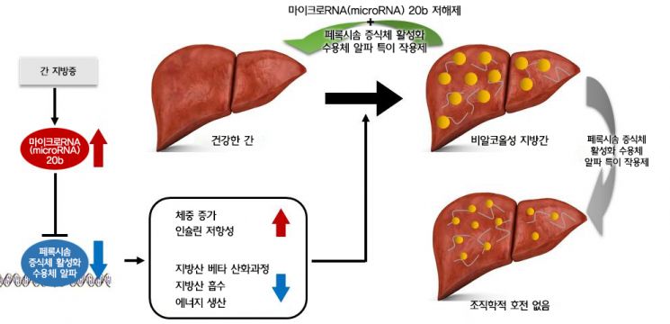 비알콜성 지방간 발병기전과 MIR20B 억제제 투여 효과를 나타낸 그림.