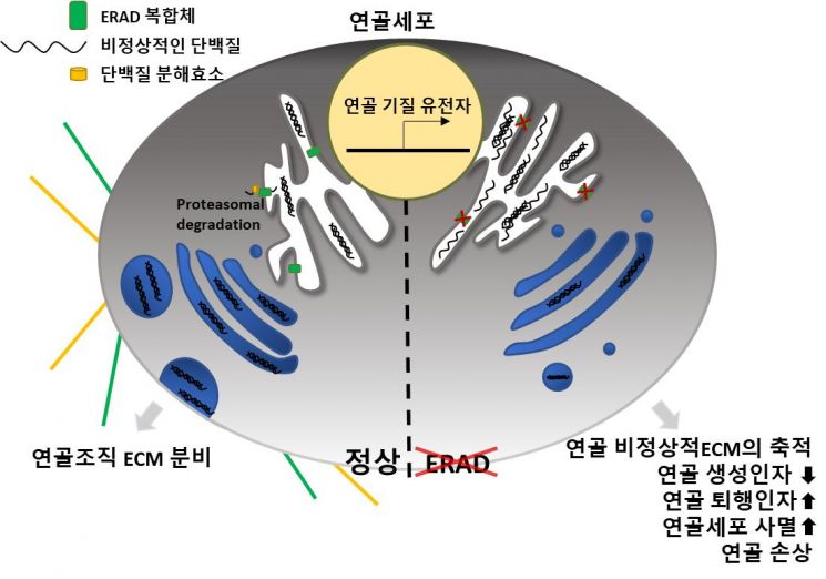 세포 소포체 내 ERAD 시스템이 고장난 연골세포(오른쪽)과 정상 연골세포(왼쪽)를 나타낸 그림.