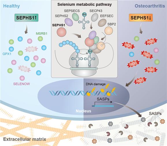 퇴행성관절염 치료법 찾았다…"셀레늄단백질 부족이 원인"