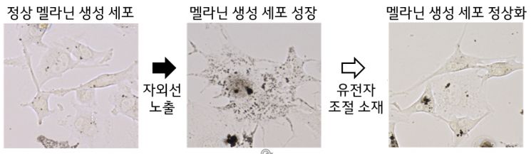 LG생활건강, 한국인 피부 색소 침착 관여 유전자 발견