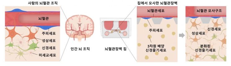 인공 뇌, 태아→신생아 수준 배양 성공