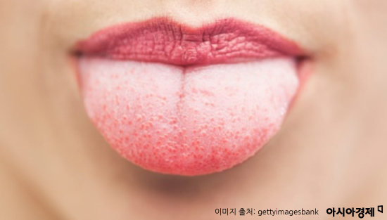 눈 가리고 입 막으면 절대 알 수 없는 질병(이진경의 건강상식)