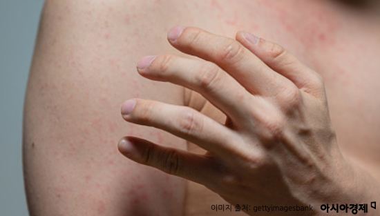 눈 가리고 입 막으면 절대 알 수 없는 질병(이진경의 건강상식)