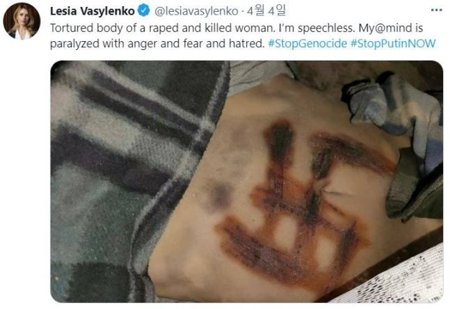 우크라이나 홀로스당 소속 하원의원 레시아 바실렌코가 4일 자신의 트위터를 통해 공개한 사진. 한 여성의 몸에 나치를 상징하는 문양이 새겨져 있다. /사진=트위터 캡처