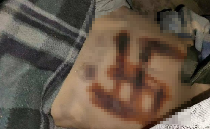 나치 문양이 새겨진 채 살해당한 여성 시신이 공개돼 논란이 일었다. 사진=트위터 화면 캡처.