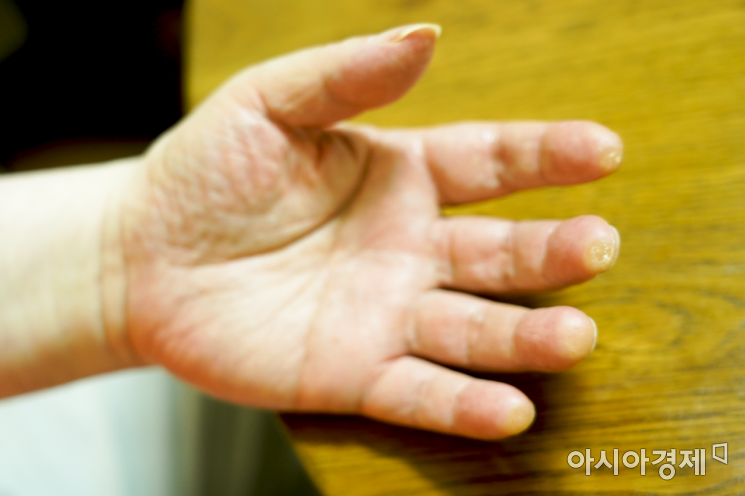 그는 매일 1시간씩 발성연습, 또 1시간은 기타연습에 매진한다고 했다. 그의 왼쪽 다섯손가락 끝 굳은살과 거친 손의 선명함이 이를 방증한다. 사진 = 윤진근PD