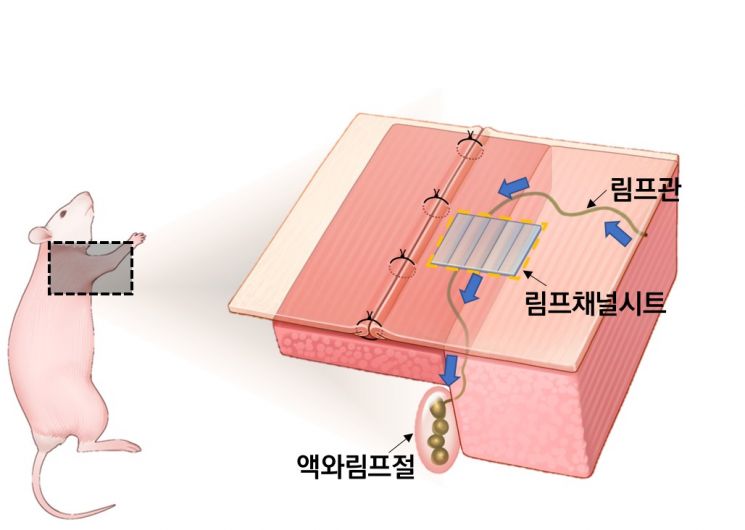 림프절이 절제된 소동물 모델에 림프채널시트를 이식한 결과, 끊어진 림프의 흐름이 회복되는 것이 확인됐다.