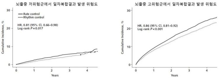 "심방세동, '조기 리듬 조절 치료'로 잡는다"