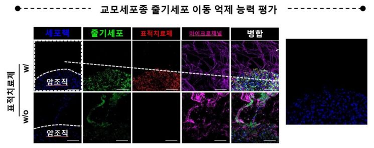 연구팀 개발 치료제를 투여했을 때 암세포 이동이 적었다.
