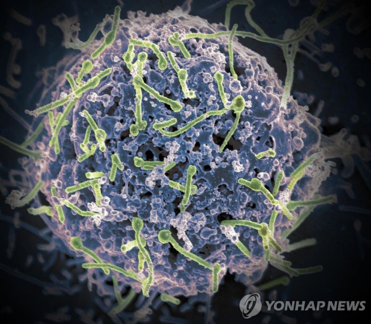 세계보건기구(WHO)에 따르면 에볼라의 치명률은 41~100%에 이른다. 사진=미 국립 알레르기 감염질환 연구소 제공