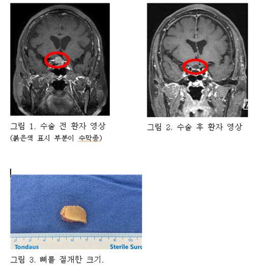 [사진제공=서울성모병원]