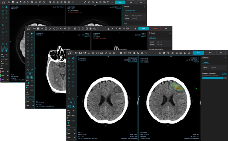JLK의 뇌졸중 솔루션 '메디허브 스트로크' (사진제공=JLK)