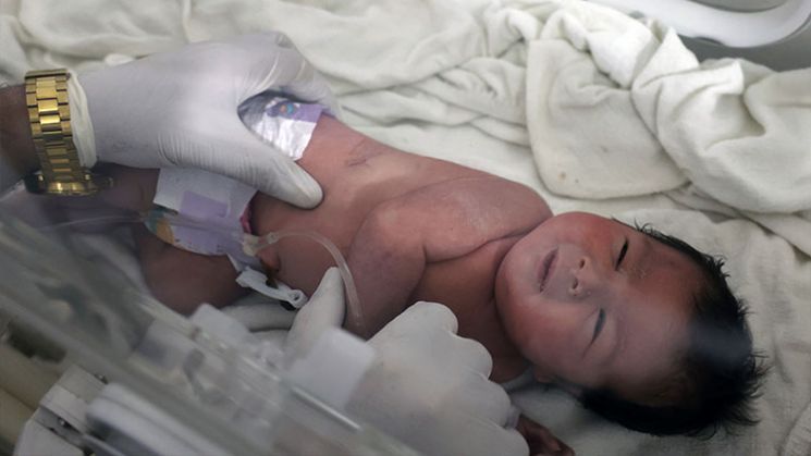 시리아 강진 피해 현장에서 구조된 신생아가 구조됐다. 사진제공=AP·연합뉴스