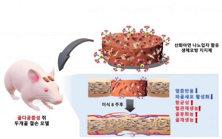 노인 낙상환자 희망 생기나…'효과 7배' 골다공증 골절 치료제 개발