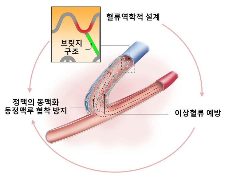 연구팀이 개발한 투석혈관 조성술 기기 개요도.[사진제공=연세의료원]