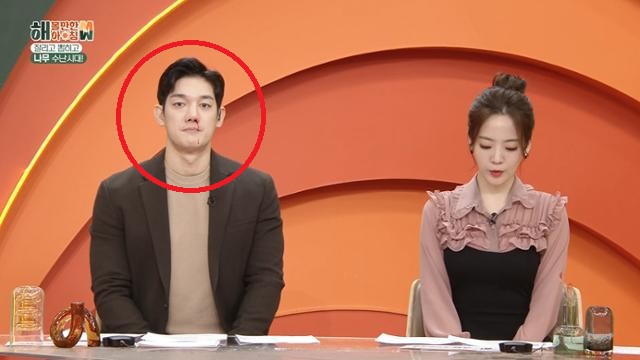박재민(왼쪽)이 '해 볼만한 아침 M&W' 생방송 중 코피를 흘리는 모습. [사진출처=KBS2 방송 화면 캡처]