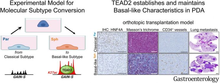췌장암 악화·전이 과정 밝혀냈다 