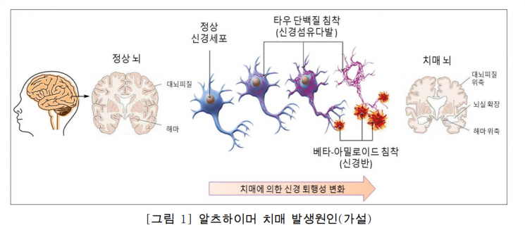 [과학을읽다]치매 정복의 길 '희망'은 있다