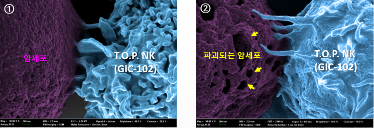 T.O.P. NK 세포치료제의 암세포 살상 과정을 전자현미경으로 촬영한 사진. [사진제공=지아이셀]