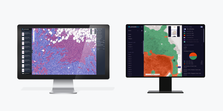 루닛의 AI 바이오마커 플랫폼 '루닛 스코프 IO(왼쪽)'과 AI 병리분석 솔루션 '루닛 스코프 PD-L1' [사진제공=루닛]