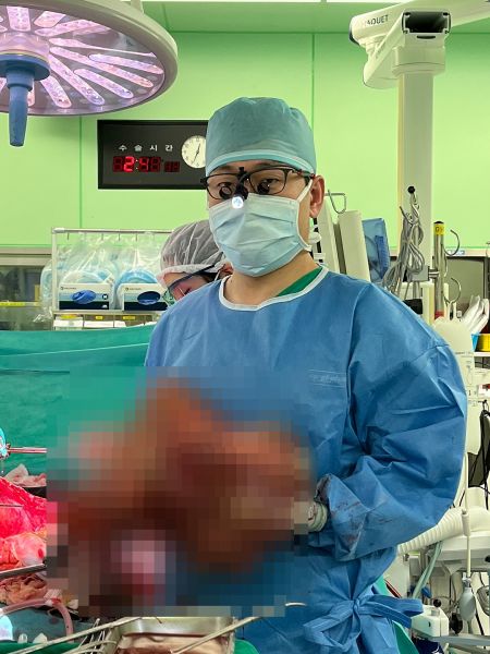 이재근 교수가 수술 당시 환자에게서 제거한 간을 들고 있다.[사진제공=연세의료원]
