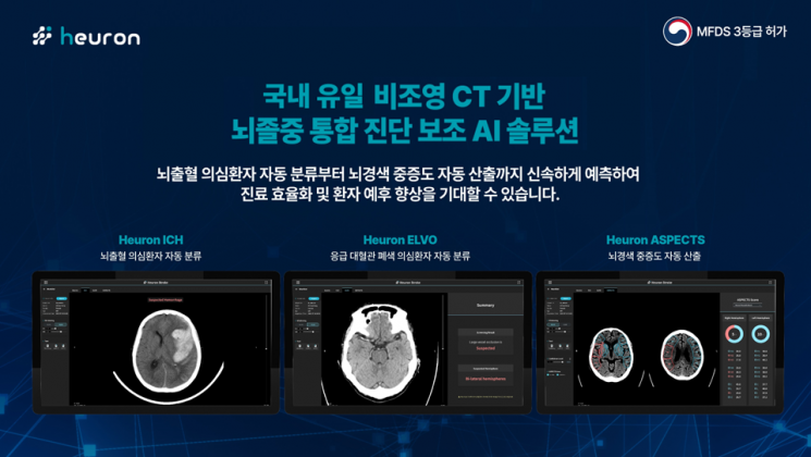 [AI혁명](36)뇌졸중 '골든타임' AI로 지킨다