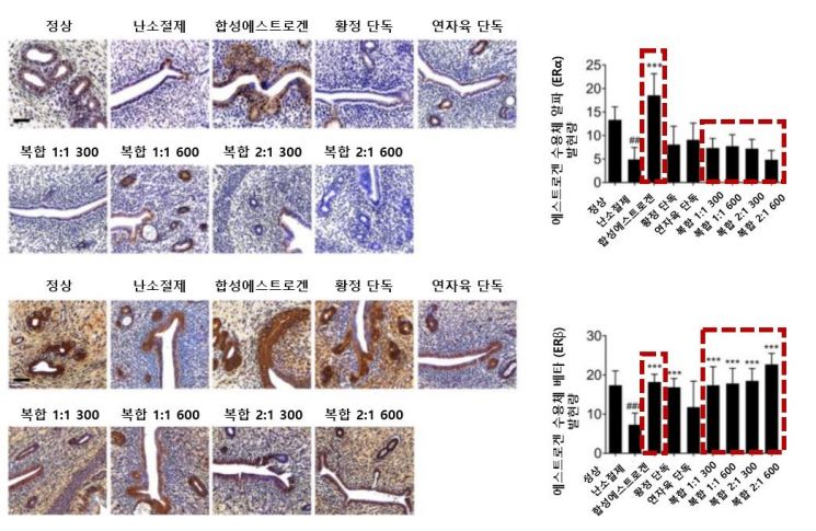 황정·연자육 복합 투여군은 대조군들에 비해 ERα 발현을 억제하고 ERβ 발현을 촉진하는 것으로 나타났다.[자료제공=자생한방병원]