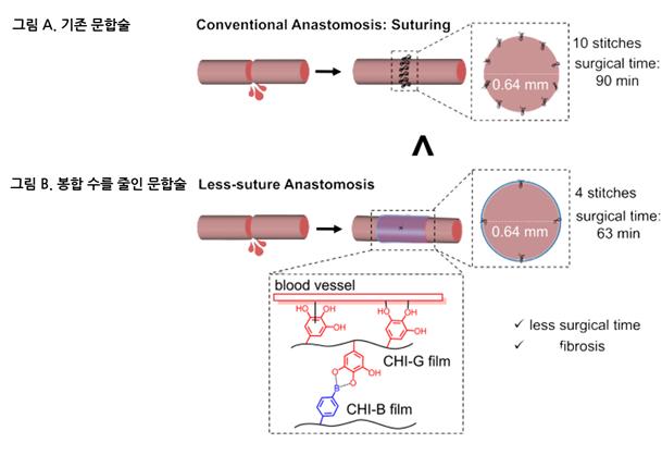 혈관 문합술에 따라 혈액응고병증 모델의 봉합 수와 수술시간을 비교하는 연구 모식도. 
그림 A는 기존 문합술의 경우 직경 0.64mm의 혈관 문합 시, 10회 봉합으로 90분이 소요되었으며, 그림 B는 문합 부위에 CHI-G 필름과 CHI-B 필름을 적용하여 같은 두께의 혈관 직경 0.64mm의 혈관 문합 시, 4회 봉합으로 63분이 소요되는 것을 확인할 수 있다. 

그림출처=안전성평가연구소 제공