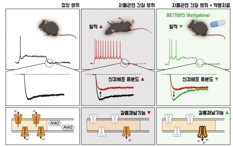 자폐 동반 간질, 약물 치료 가능성 확인