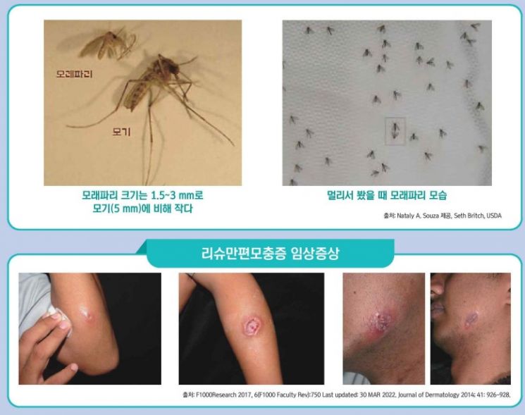 '모기만 무는 게 아니네'…모래파리 옮긴 피부기생충 환자 2년만에 발생