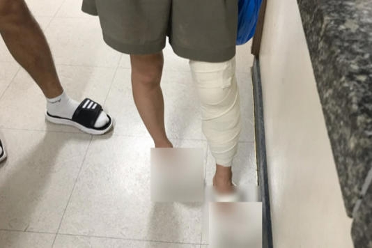 싸이 흠뻑쇼 여수 공연 후 관객이 부상을 입어 붕대를 감은 모습. [이미지출처=노컷뉴스 보도화면 캡처]