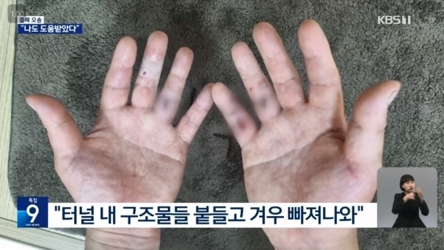 지난 15일 침수된 오송 지하차도 난간에 매달린 채 다른 시민들을 구한 증평군청 공무원 정영석씨가 구조 활동으로 상처투성이가 된 자신의 손을 공개했다. 사진출처=KBS
