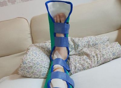 아기를 안고 계단에서 굴러 다리를 다쳤다는 A씨 [사진출처=온라인 커뮤니티 보배드림]