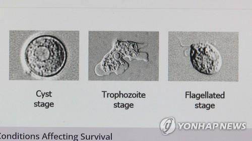 파울러자유아메바 [사진출처=연합뉴스]