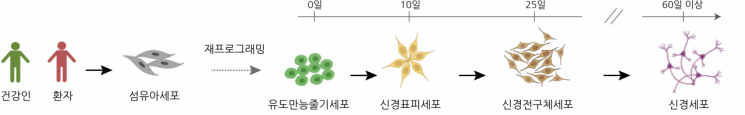 인공지능으로 파킨슨병 맞춤형 치료한다