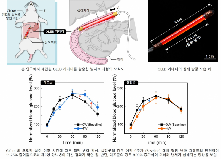 OLED 카테터를 활용한 빛 치료 과정의 모식도와 디바이스 . 사진출처=카이스트 제공