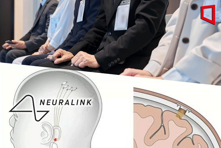 '뇌에 칩 이식' 머스크 뉴럴링크, 임상시험 위한 첫 인간 대상자 모집